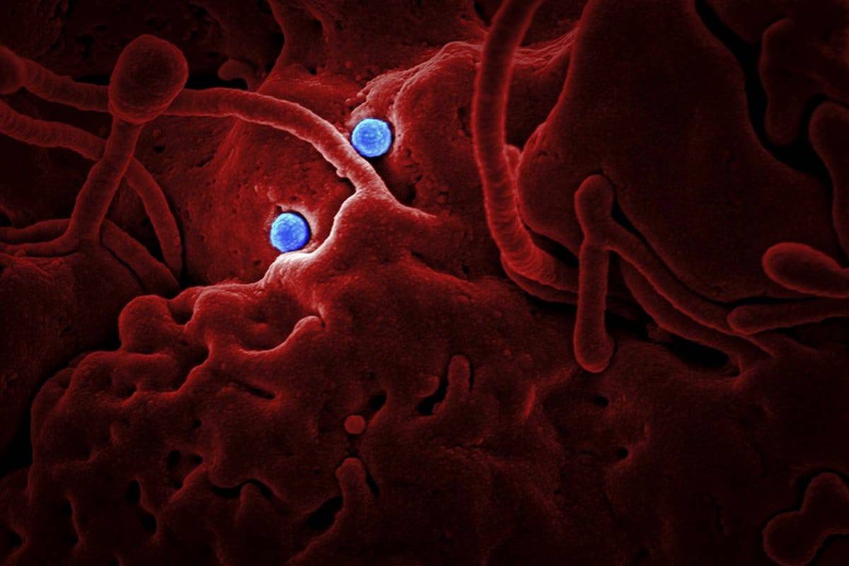 India, Pakistan coronavirus cases spike as their economies falter
