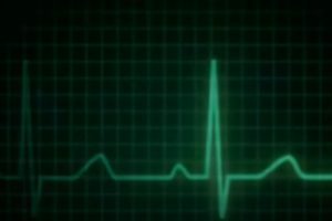 AI algorithm heart failure