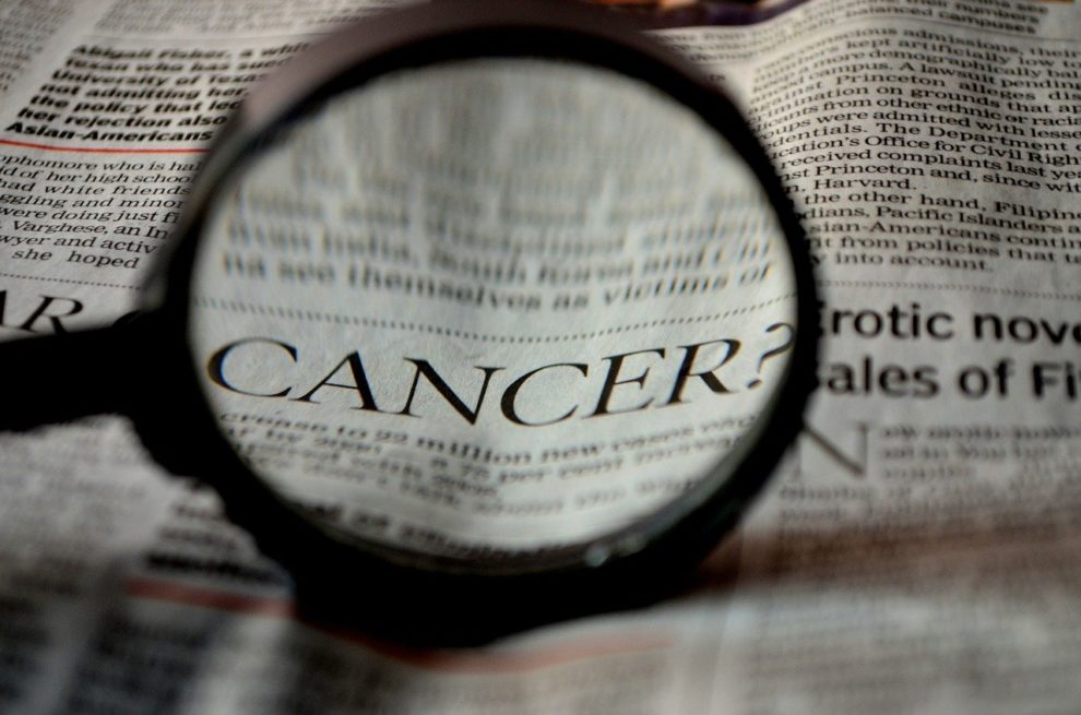 Cancer surging among under-50s worldwide, study says