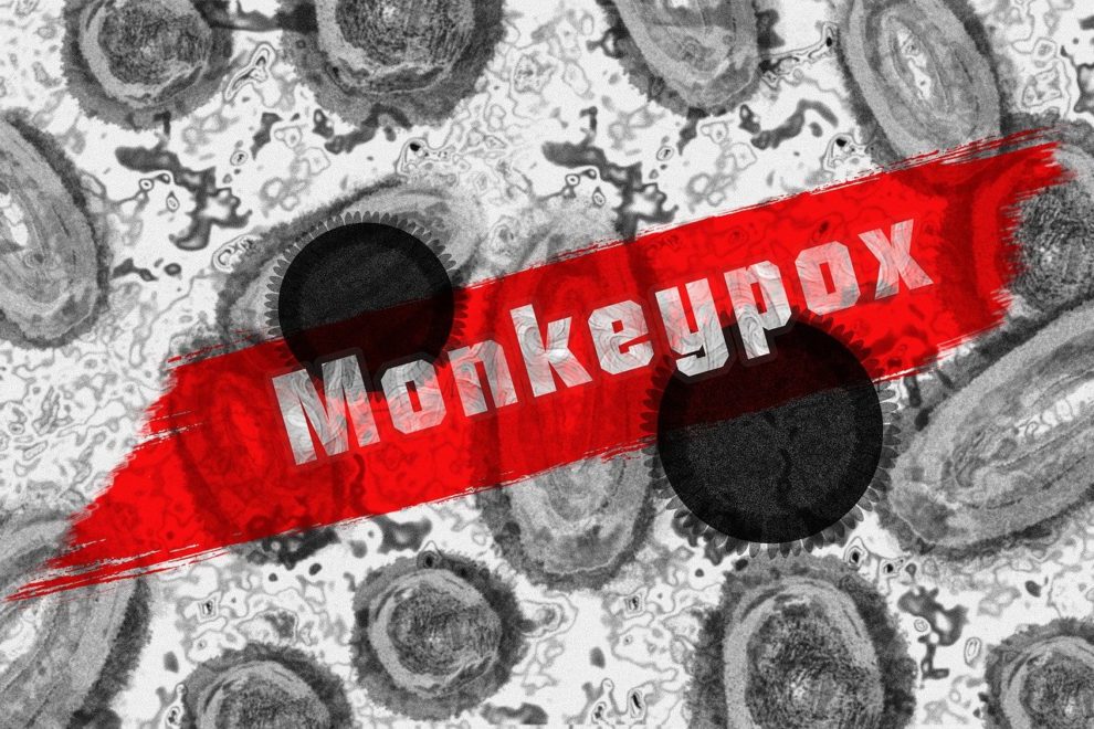 Roche monkeypox PCR tests