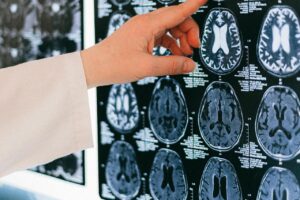 "India health alert after 'brain-eating' amoeba rise