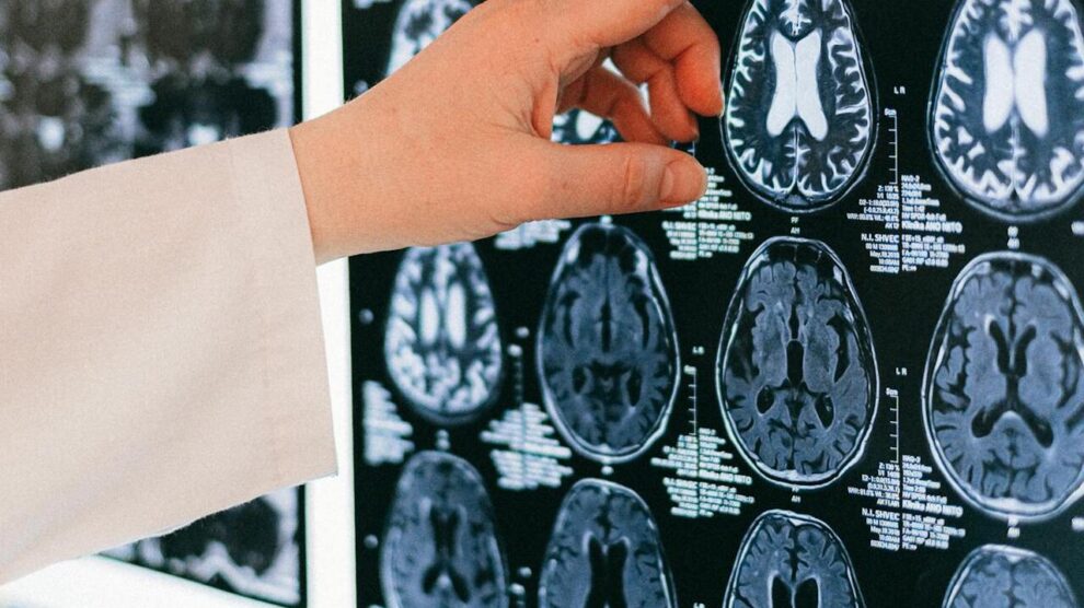 "India health alert after 'brain-eating' amoeba rise